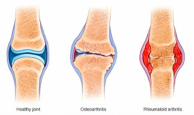 50% Off + Free Shipping Limited Only